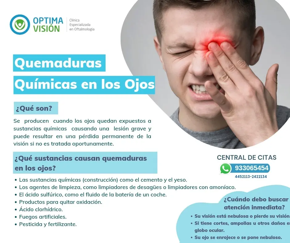 acido de bateria en el ojo - Cómo curar una quemadura ocular