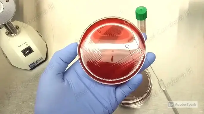 cultivo de baterias en agal - Cómo preparar agar para cultivo de bacterias