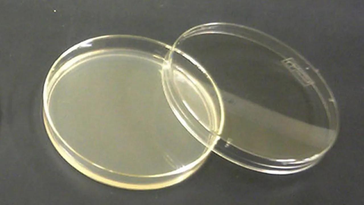 cultivos de baterias en caja petri - Cómo se preparan los medios de cultivo en caja Petri