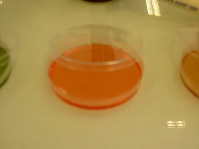 baterias que pueden crecer en agar sal y manitol - Qué tipos de microorganismos crecen en los siguientes agares nutritivo sangre y sal y manitol
